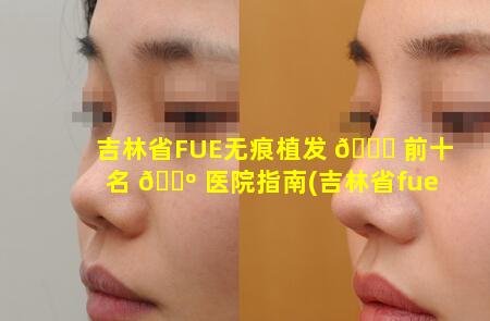 吉林省FUE无痕植发 🐝 前十名 🐺 医院指南(吉林省fue无痕植发前十名医院指南)